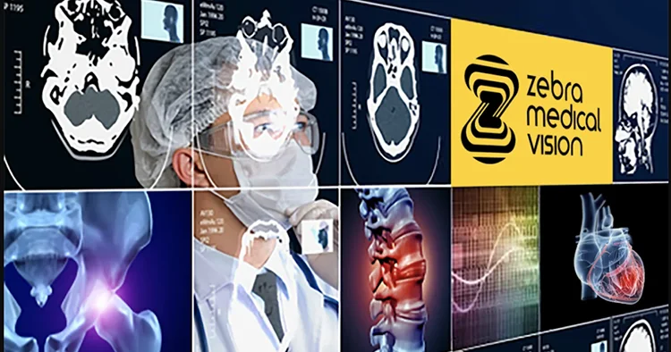 ابزار هوش مصنوعی Zebra Medical Vision برای پزشکان ارتوپد
