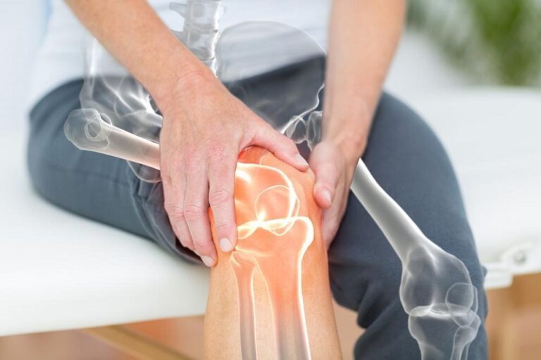 پیشگیری از سائیدگی کشک زانو (Patellofemoral Osteoarthritis): جدیدترین روش‌ ها و استراتژی‌ ها