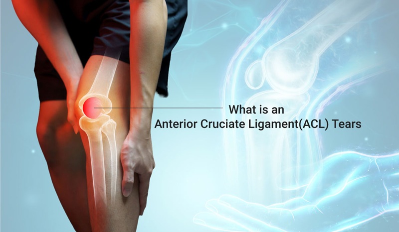 چه ورزش‌هایی بیشترین پارگی رباط صلیبی قدامی (ACL) را ایجاد می‌کنند؟